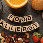 Assortment of common food allergens including nuts, eggs, fruit and bread with wooden blocks spelling “Food Allergy”