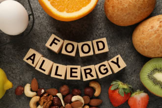 Assortment of common food allergens including nuts, eggs, fruit and bread with wooden blocks spelling โFood Allergyโ